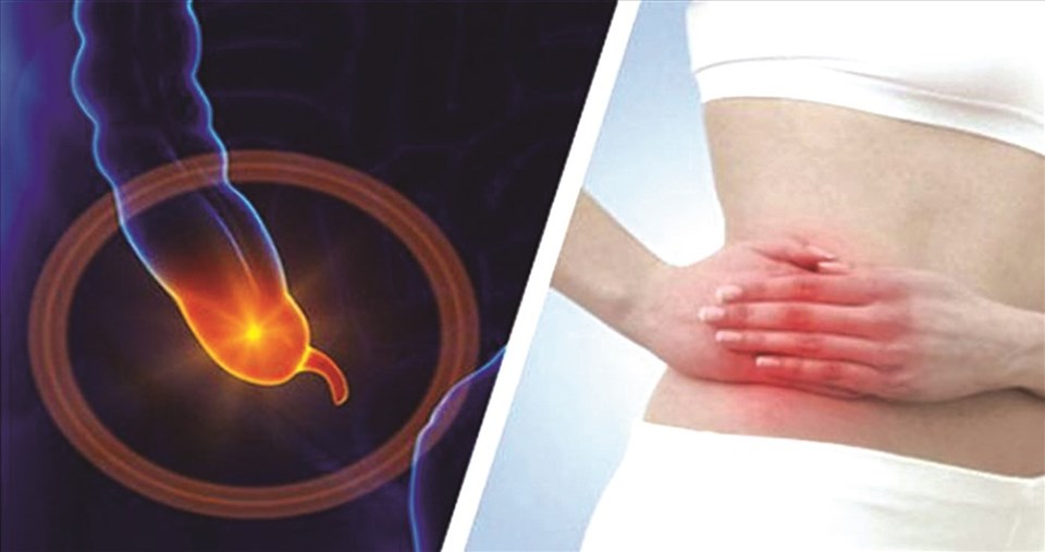 Không nên coi nhẹ viêm ruột thừa. Không nên coi nhẹ viêm ruột thừa.