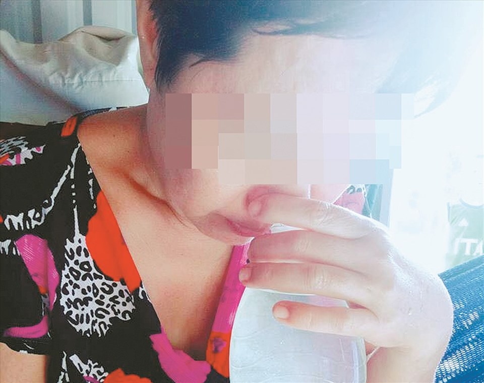 Trị viêm xoang bằng hít nước muối hột ngâm rượu. Trị viêm xoang bằng hít nước muối hột ngâm rượu.