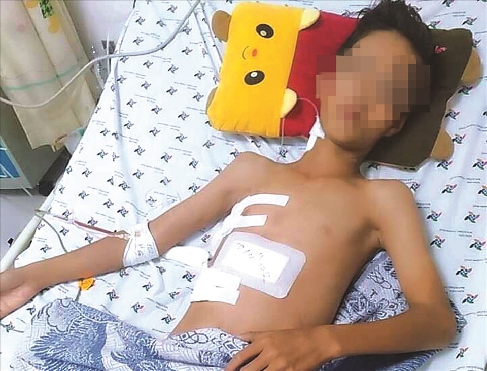 Một trường hợp trẻ té ngã dẫn đến vết thương nghiêm trọng. Một trường hợp trẻ té ngã dẫn đến vết thương nghiêm trọng.
